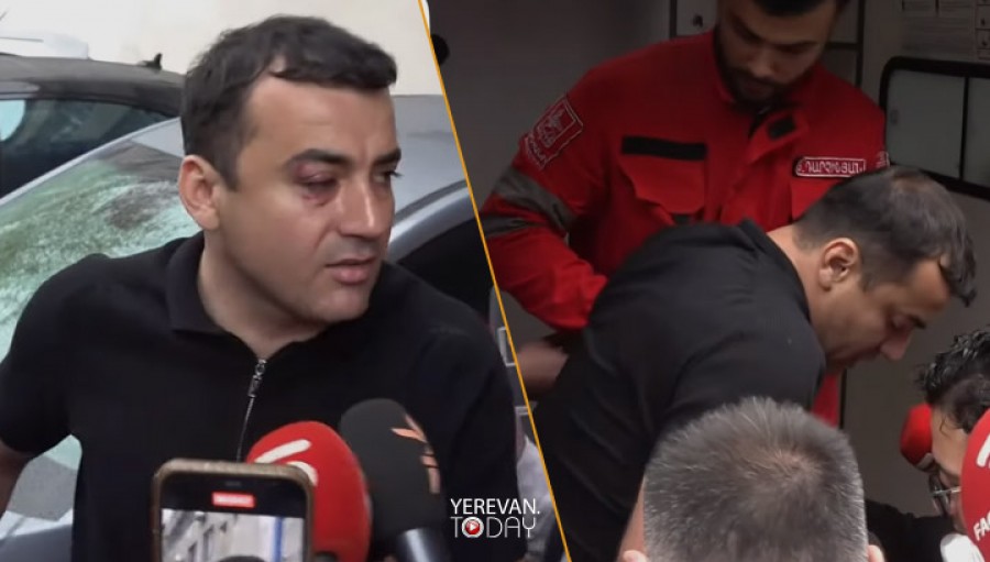 Արթուր Չախոյանը շտապօգնության մեքենայով տեղափոխվել է հիվանդանոց