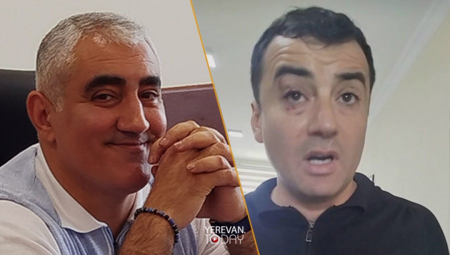 Մասիվի ՔՊ-ական թաղապետը &laquo;յուրաքանչյուր նորմալ մարդու&raquo; պահվածք է համարում մի քանի հոգով մեկին ծեծի ենթարկելը